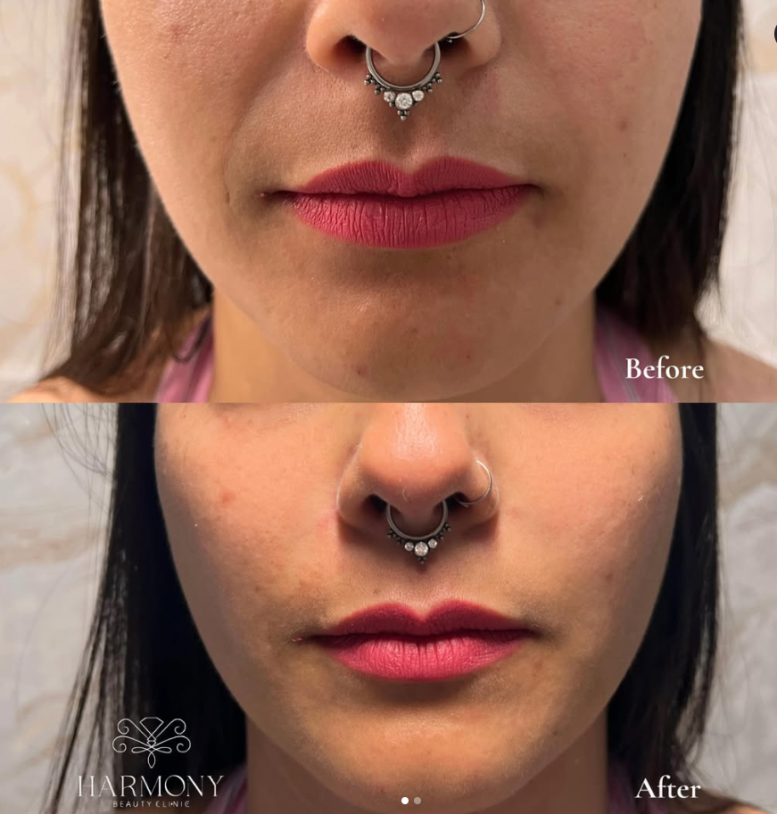 HARMONY BEAUTY CLINIC