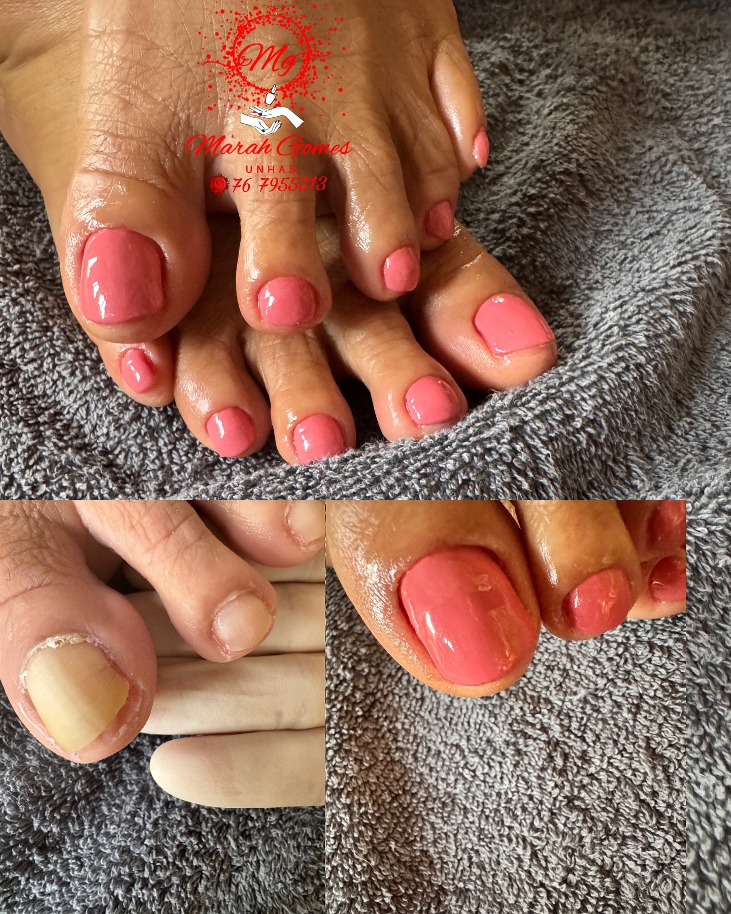 Marah Gomes Unhas